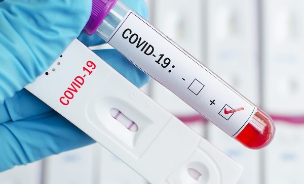 1141 са новите случаи на коронавирус през последното денонощие у
